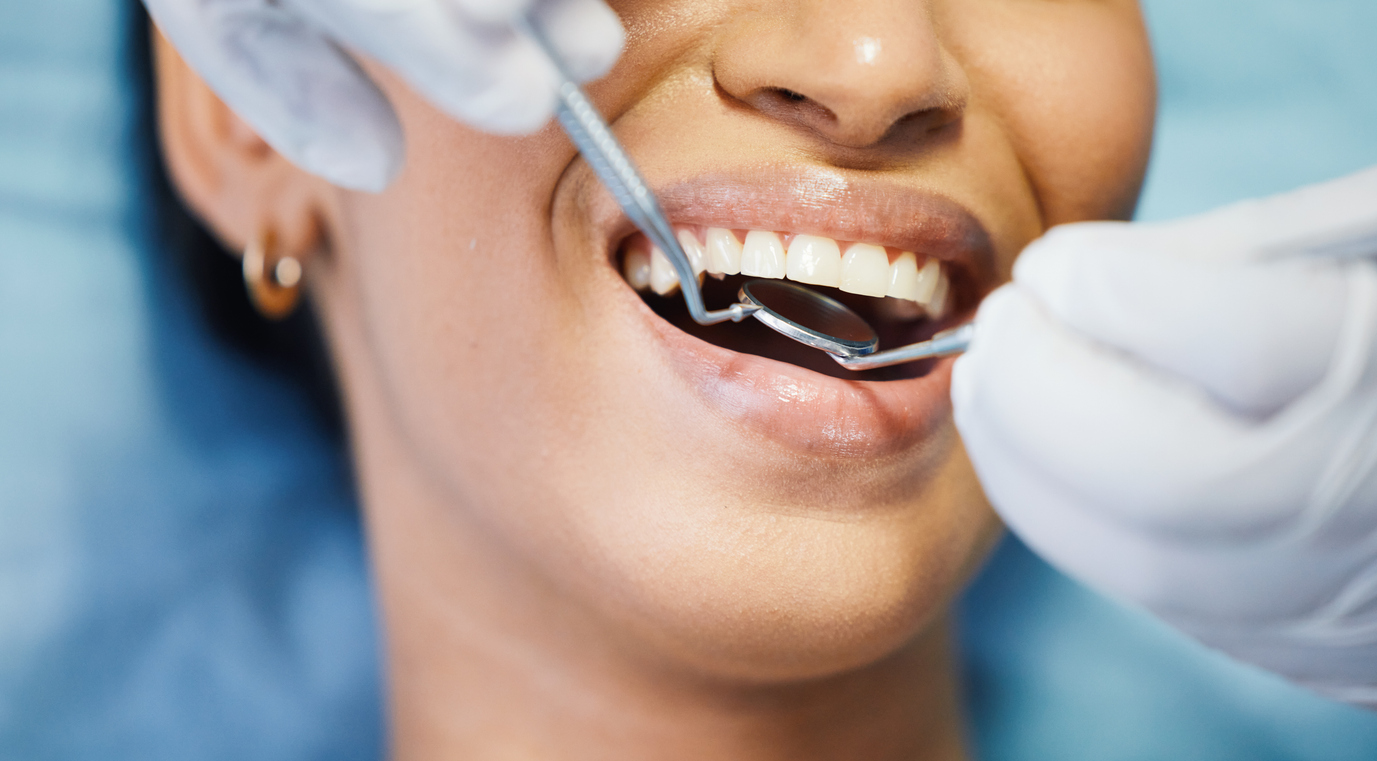 Teeth cleaning in Portland Oregon